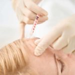 injectare botox in riduri frunte