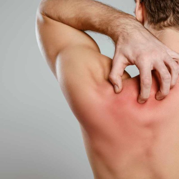 Remedii eficiente pentru febra musculară